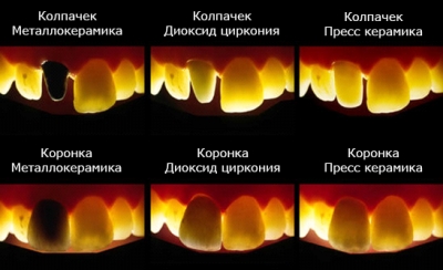 Светопропускание металлокерамики, диоксида циркония и прессованной керамики