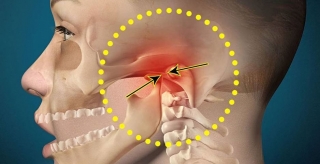 Возможные боли, связанные с височно-нижнечелюстным суставом