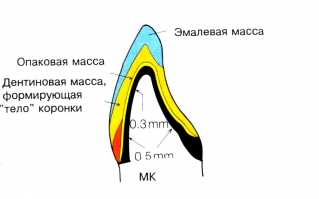 Срез металлокерамической коронки