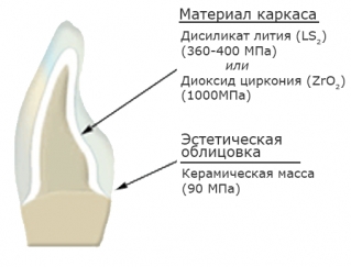 Срез керамической коронки. Не винир, но суть картинки та же 