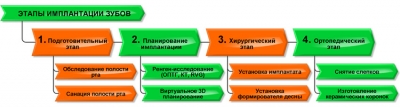 Основные этапы при имплантации зубов