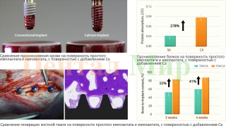 Характеристики покрытия Osstem CA