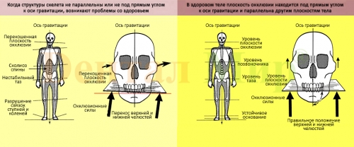 Влияние осанки на окклюзию. Взаимосвязь с прикусом