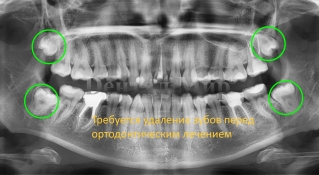 Исследование ОПТГ