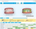 Моделиро-вание Invisalign