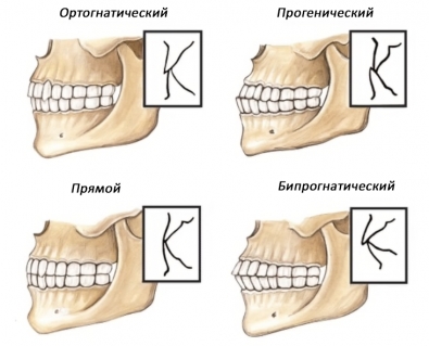 Физиологический нормальный прикус