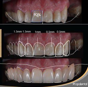 digital_smile_disign