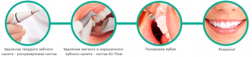 Этапы профессиональной чистки зубов