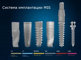 Имплантаты MIS