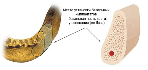 Базальная кость