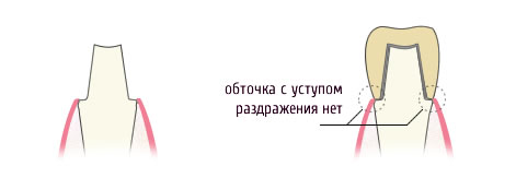 Металлокерамика с уступом и плечевой массой
