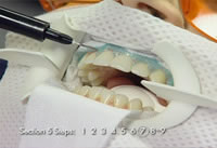 Discus Dental