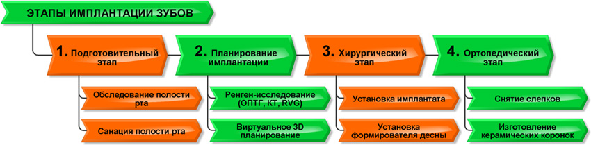 Этапы имплантации зубов