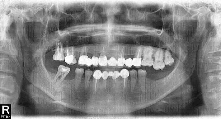 ортопантомограммы